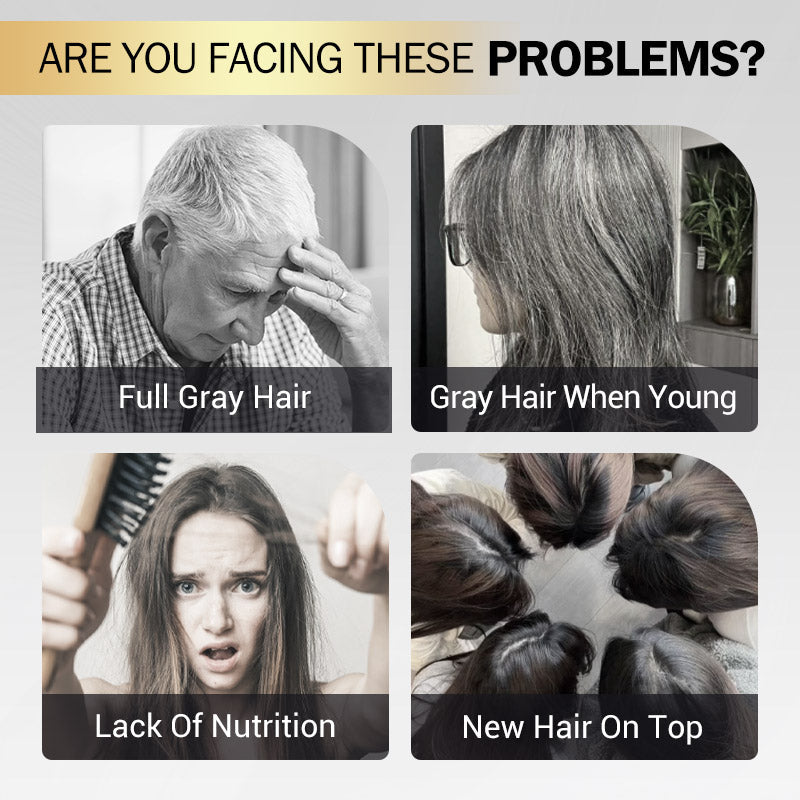 🔥2025 NEW SALES - 50% OFF🔥10-Pack Plant Extract Non-damage Hair Dye Cream