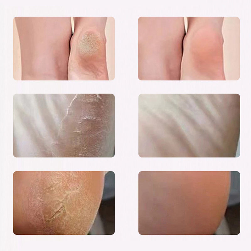 🔥HOT SALE 50% OFF🔥Electric Foot Scrubber for Smooth Healthy Skin