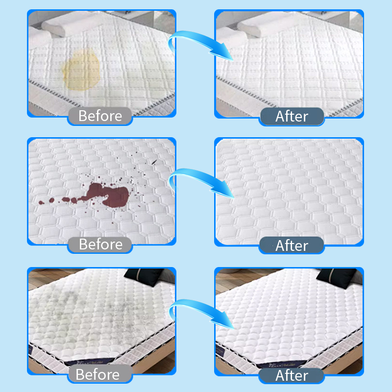 🎉Hot Sale 49% OFF🎉 Powerful Mattress Yellow Stain Cleaner