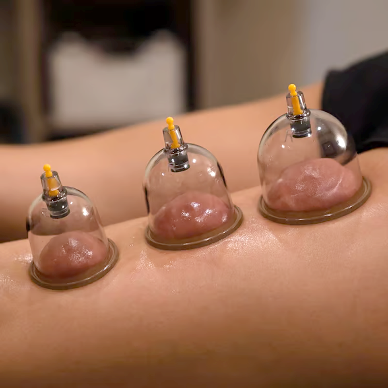 Thickened Vacuum Cupping Set with Suction Pump