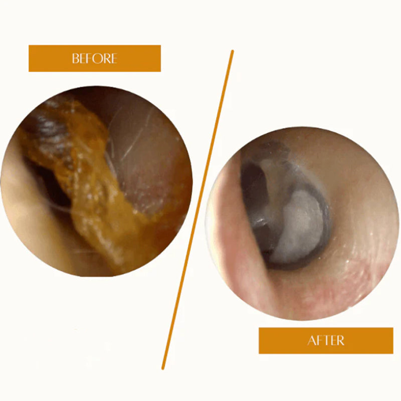 🔥Hot Sale🔥Painless Ear Cleaning for the Whole Family