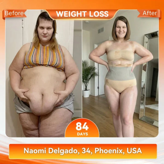 🥳2026 HOT SALE🥳💞50K+ SOLD!🌸🧘‍♀️ 50% OFF! Thermogenic Tummy Control Shorts – 30‑min daily wear, activates warmth & boosts circulation. Supports firmer, smoother contour. No gym needed. A smart shapewear choice. 👵✨