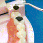 304 stainless steel toothpick oral care cleaning tool