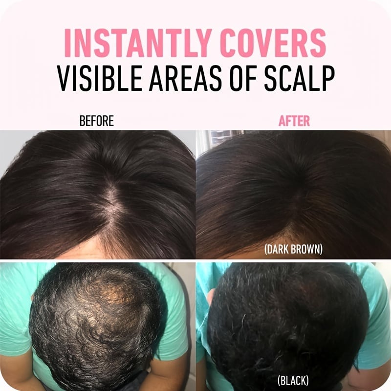 🔥🔥BUY 1 GET 1 FREE💗Hairline Powder  (fit all hair color)🌈