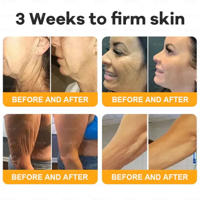 🔥Last Day Promotion 60% OFF⚡50K+ SOLD!✨Organic Beef Tallow Balm with Honey – Moisturizing Cream