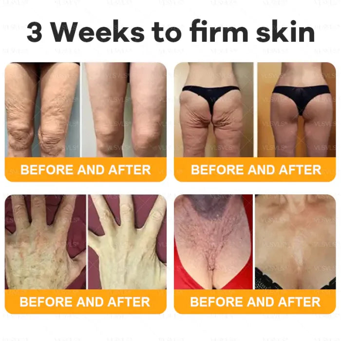 🔥Last Day Promotion 60% OFF⚡50K+ SOLD!✨Organic Beef Tallow Balm with Honey – Moisturizing Cream