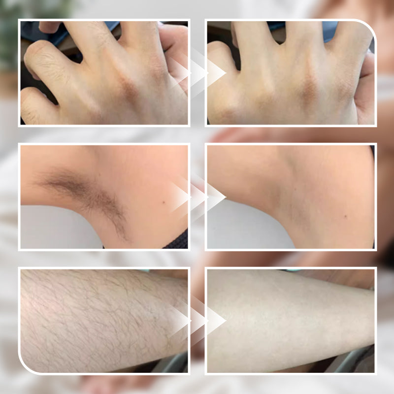 🌈250g Gentle Hair Removal Cream for Men and Women