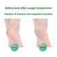 🔥Hot Sale 50% off- Antibacterial Foot Wash For Stinky Feet With 360° Brush
