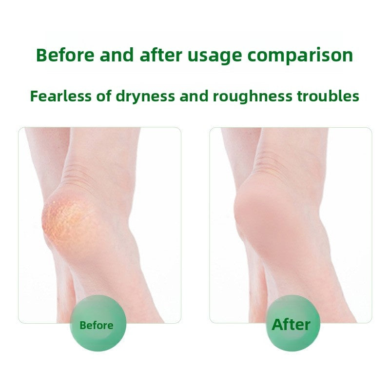 🔥Hot Sale 50% off- Antibacterial Foot Wash For Stinky Feet With 360° Brush