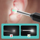 Endoscopic Visual Ear Picker