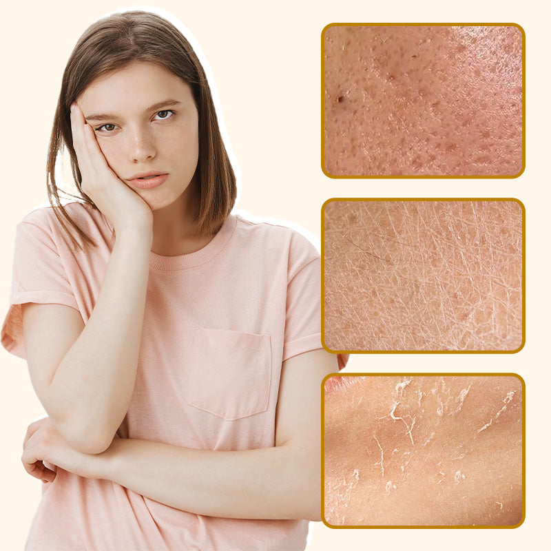 🔥Last Day Promotion 60% OFF⚡50K+ SOLD!✨Organic Beef Tallow Balm with Honey – Moisturizing Cream