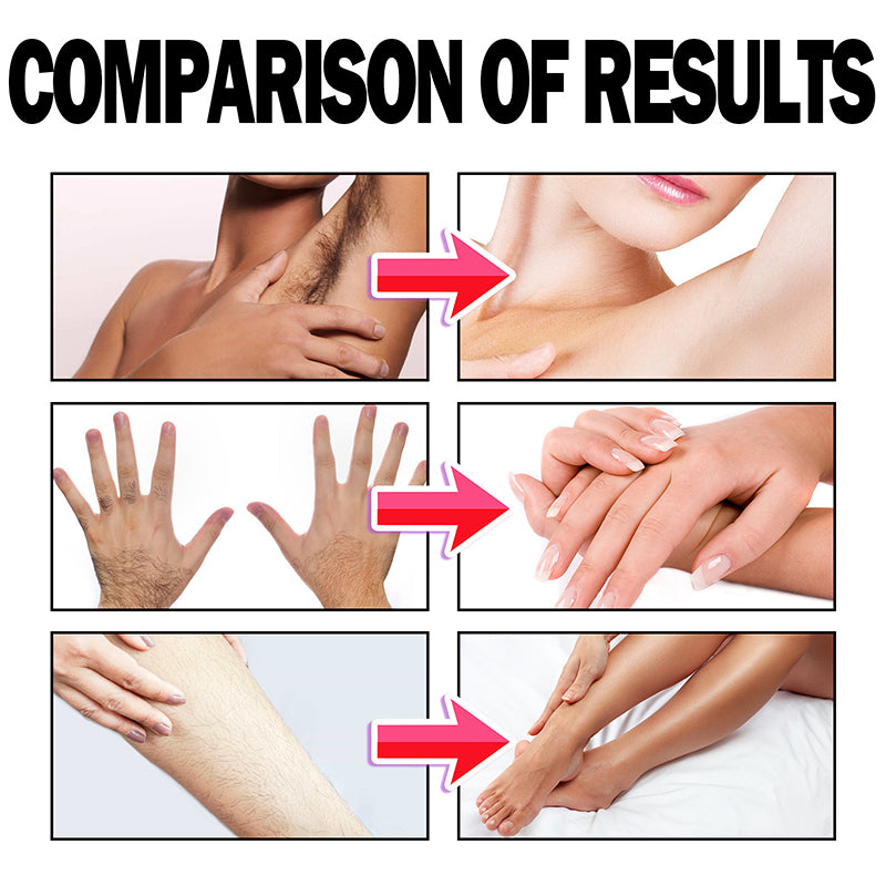 Smooth Skin Hair Removal Foam Spray