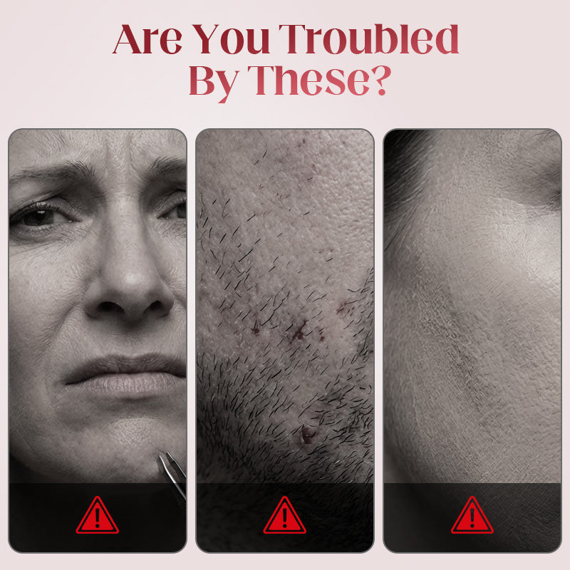 🔥Limited-time offer-Electric Cotton Thread Facial Hair Remover