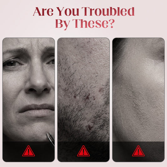 🔥Limited-time offer-Electric Cotton Thread Facial Hair Remover