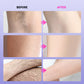 🔥Limited-time offer-Multi-Use Gentle Effective Hair Removal Cream