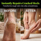 🔥Limited-time offer-Tea Tree Oil Foot Cream for Dry Cracked Feet